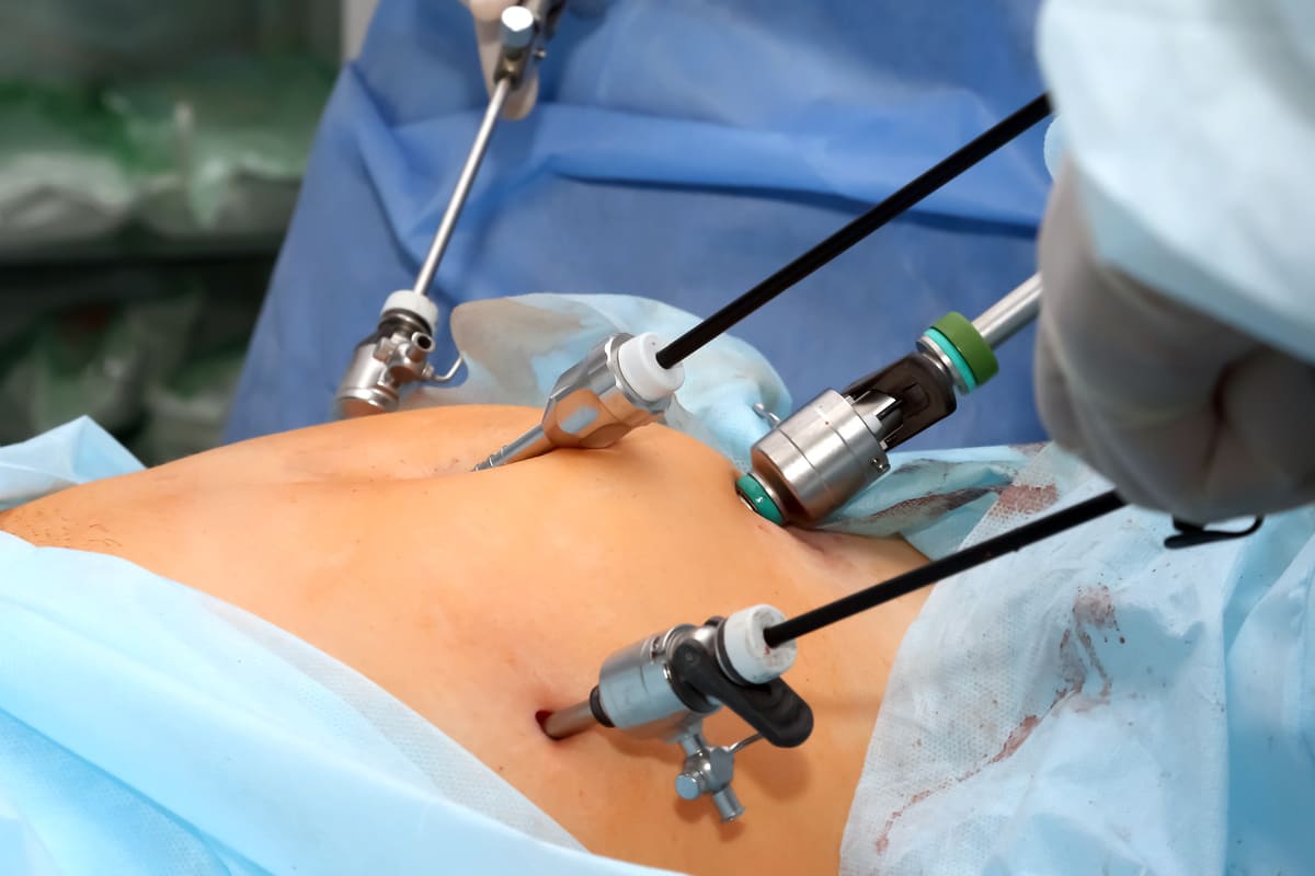 Especialista en tracto gastrointestinal en Tijuana B.C