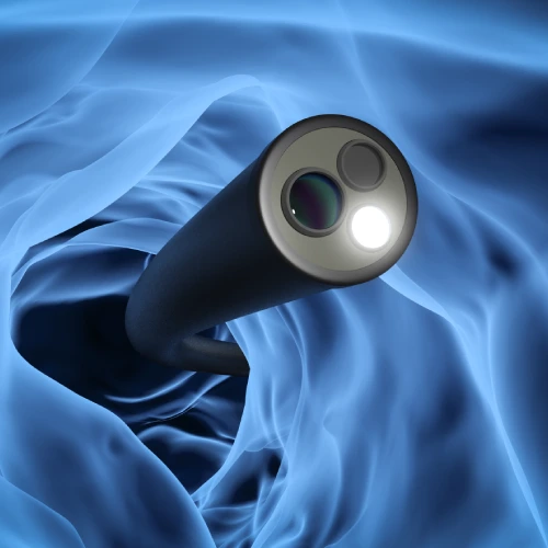 Endoscopia alta en tijuana