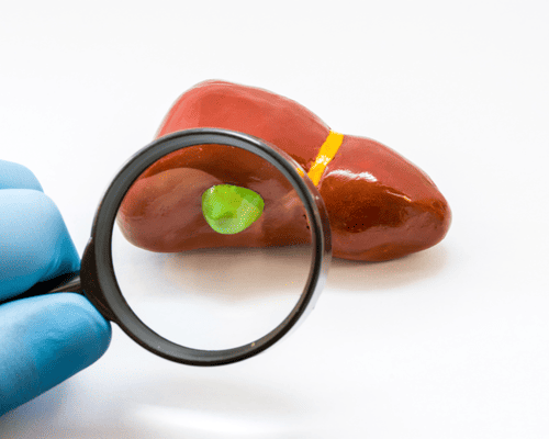 especialista-vesicula-tijuana-cerca-de-mi