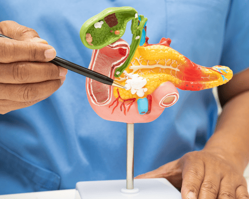 especialista-vesicula-tijuana-cerca